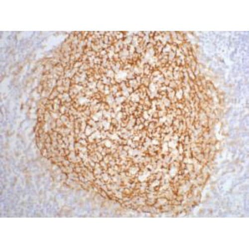Monoclonal Mouse anti-Human CR2 / CD21 Antibody (clone 2C5, IHC)