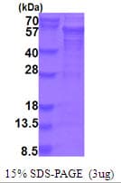Human PICK1 Protein (Recombinant His)