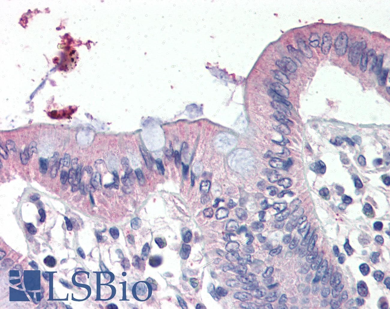 IHC-plus™ Polyclonal Goat anti-Human SCNN1G / ENaC Gamma Antibody (aa637-648, IHC)