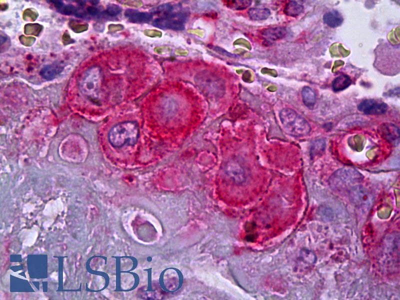 IHC-plus™ SERPINE1 / PAI-1 Antibody