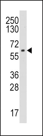 Polyclonal Rabbit anti-Human CYP19 / Aromatase Antibody (aa221-253, WB)