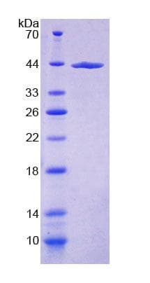 Human Collagen VI Protein (Recombinant His-T7, N-terminus)
