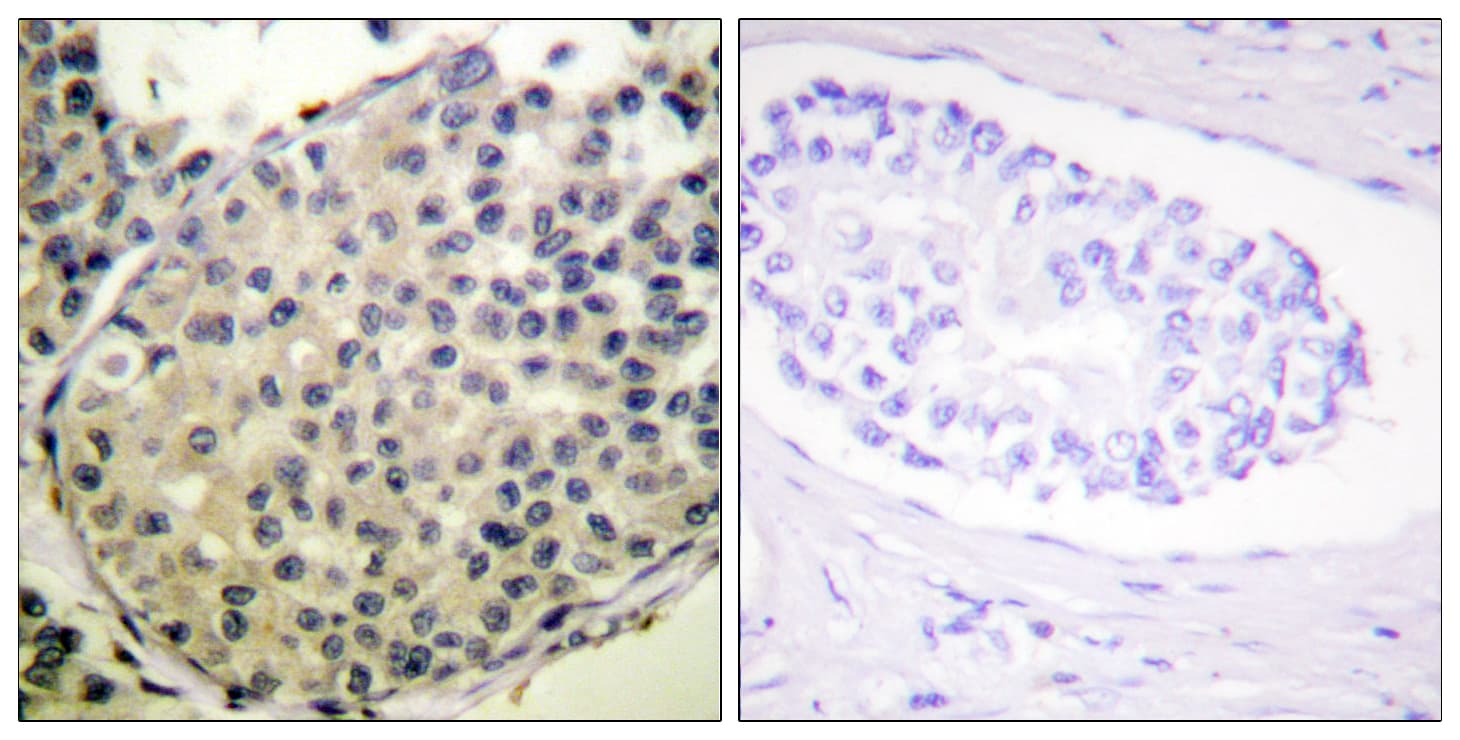 EIF4G1 / EIF4G Antibody (phospho-Ser1108)