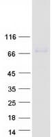 Human CFI / Complement Factor I Protein (Recombinant Myc-DDK (Flag))