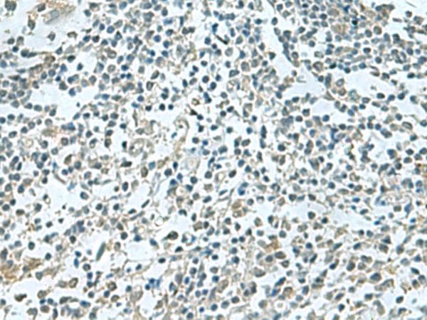 SHOOTIN1 / KIAA1598 Antibody
