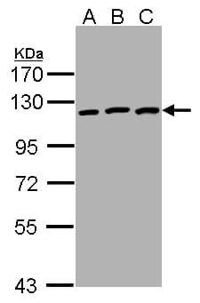 Polyclonal Rabbit anti-Human EPHB3 / EPH Receptor B3 Antibody (WB)