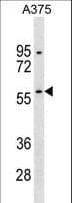 RBCK1 Antibody (aa1-30)