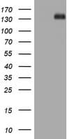 Hamartin / TSC1 Antibody (clone OTI5A7)
