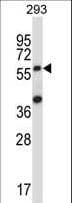 SOCS6 / SOCS-6 Antibody (aa40-69)