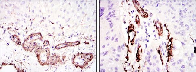 ACTA2 / Smooth Muscle Actin Antibody (clone 4F4)
