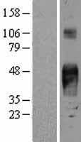 TROP2 / TACSTD2 Protein (Over-Expression Lysate Myc-DDK (Flag))
