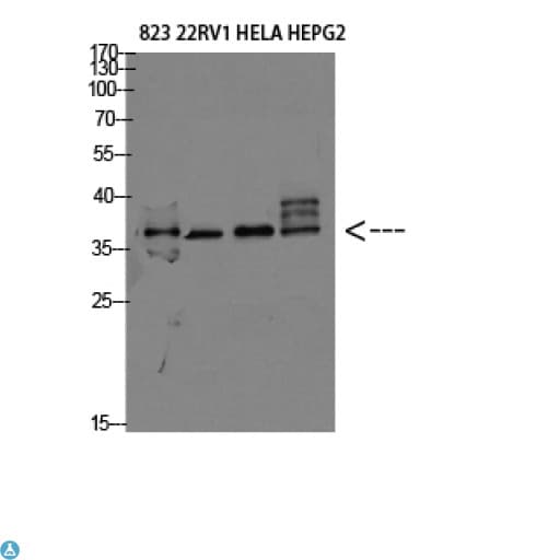TMEPAI / PMEPA1 Antibody