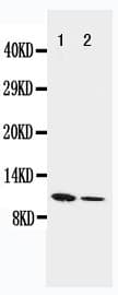 RETN / Resistin Antibody (aa93-114)