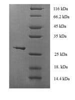 Human GPX1 / Glutathione Peroxidase Protein (Recombinant 6His, N-terminus)