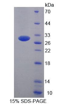 Human UBE2S / E2 EPF Protein (Recombinant His-T7, N-terminus)