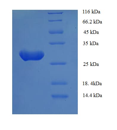 Human ASGR1 / ASGPR Protein (Recombinant 6His, N-terminus)