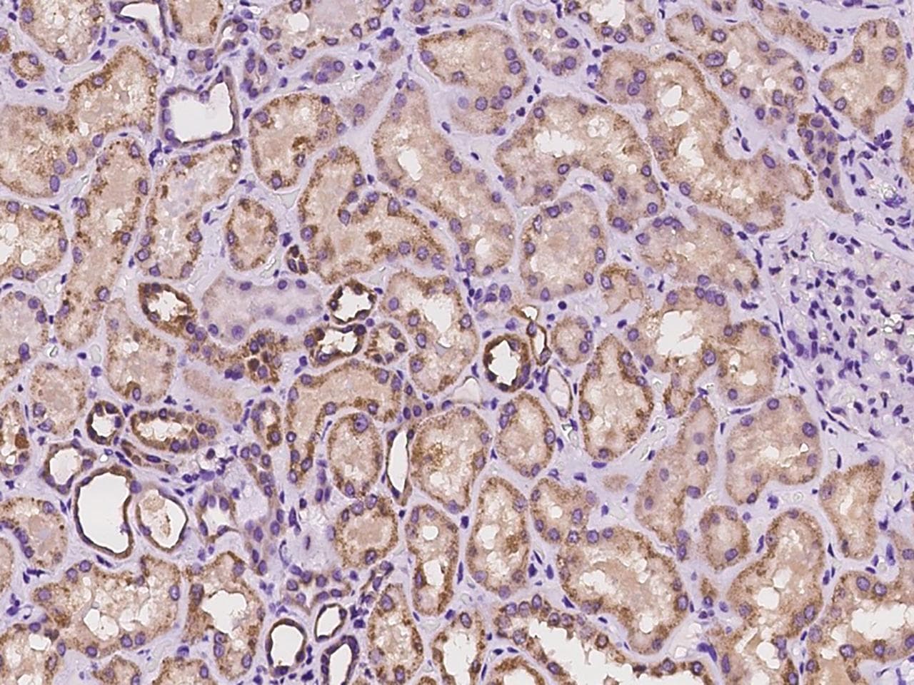 CHUK / IKKA / IKK Alpha Antibody