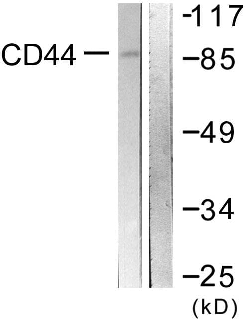 Polyclonal Rabbit anti-Human CD44 Antibody (p433, IHC, WB)