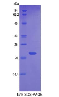 Mouse GLO1 / Glyoxalase I Protein (Recombinant His)