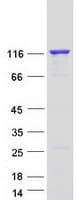 Human SNCAIP / Synphilin 1 Protein (Recombinant Myc-DDK (Flag))