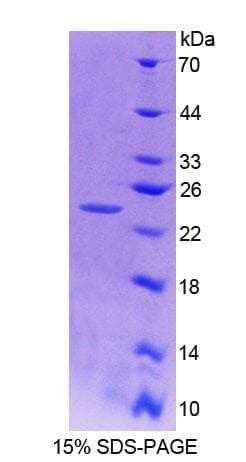 Human CTSB / Cathepsin B Protein (Recombinant His)