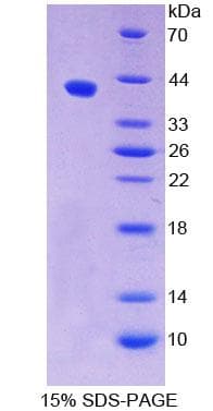Bovine DEFB1 / BD-1 Protein (Recombinant His-GST)