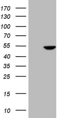 PDIA6 / ERP5 Antibody (clone OTI1G10)