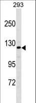 Polyclonal Rabbit anti-Human AFF2 / OX19 Antibody (aa886-912, WB)