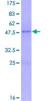 Human FGF10 Protein (Recombinant GST)