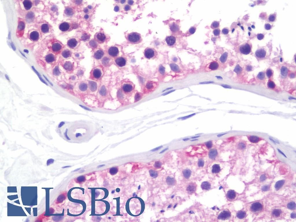 IHC-plus™ IMPDH1 Antibody (aa487-514)