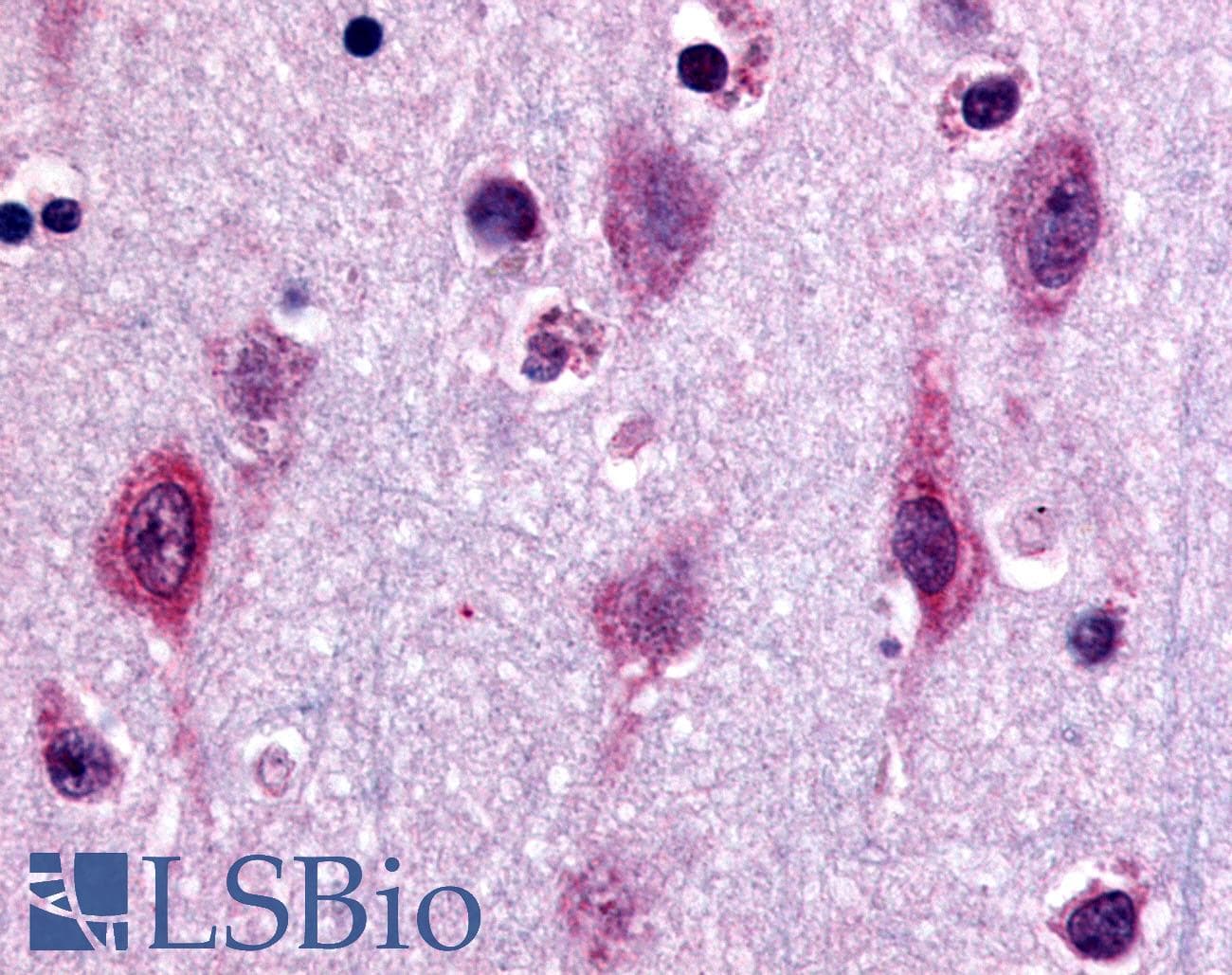 PathPlus™ MAPK3 / ERK1 Antibody (Internal)
