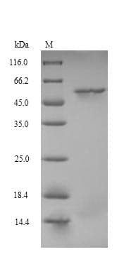 Mouse CRBN / Cereblon Protein (Recombinant 10His, N-terminus + Myc, C-terminus)