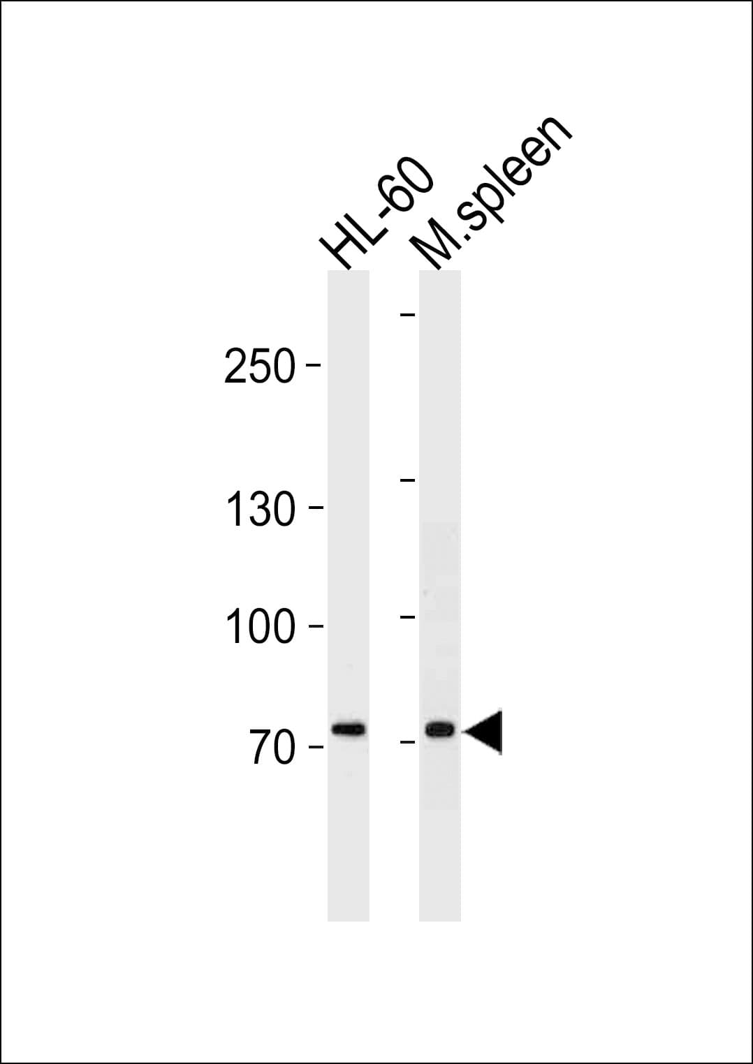 Polyclonal Rabbit anti-Human BLIMP1 / PRDM1 Antibody (aa106-134, WB)