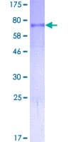 Human TP53 / p53 Protein (Recombinant GST)