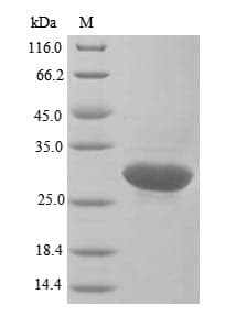 Human GSTP1 / GST Pi Protein (Recombinant 10His, N-terminus)