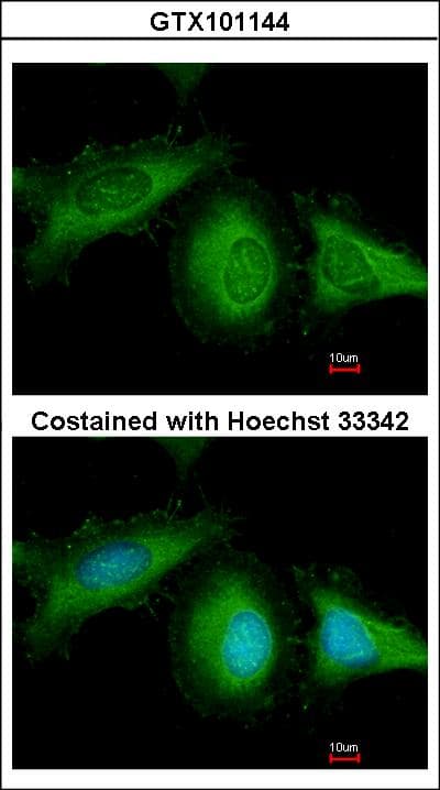 Polyclonal Rabbit anti-Human HSPA8 / HSC70 Antibody (IF, WB)