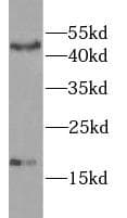 Gastric Inhibitory Peptide Antibody