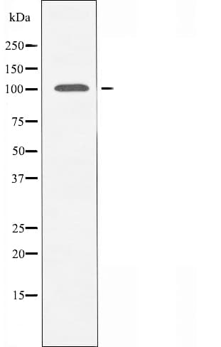 N4BP1 Antibody