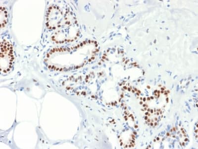 ER Alpha / Estrogen Receptor Antibody (clone rESR1/1935)