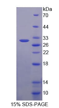 Human ABCC3 / MRP3 Protein (Recombinant His-T7)