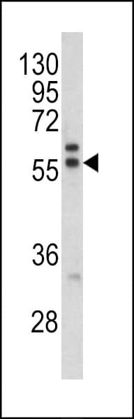 Polyclonal Rabbit anti-Human PRAME Antibody (aa476-502, IHC, WB)