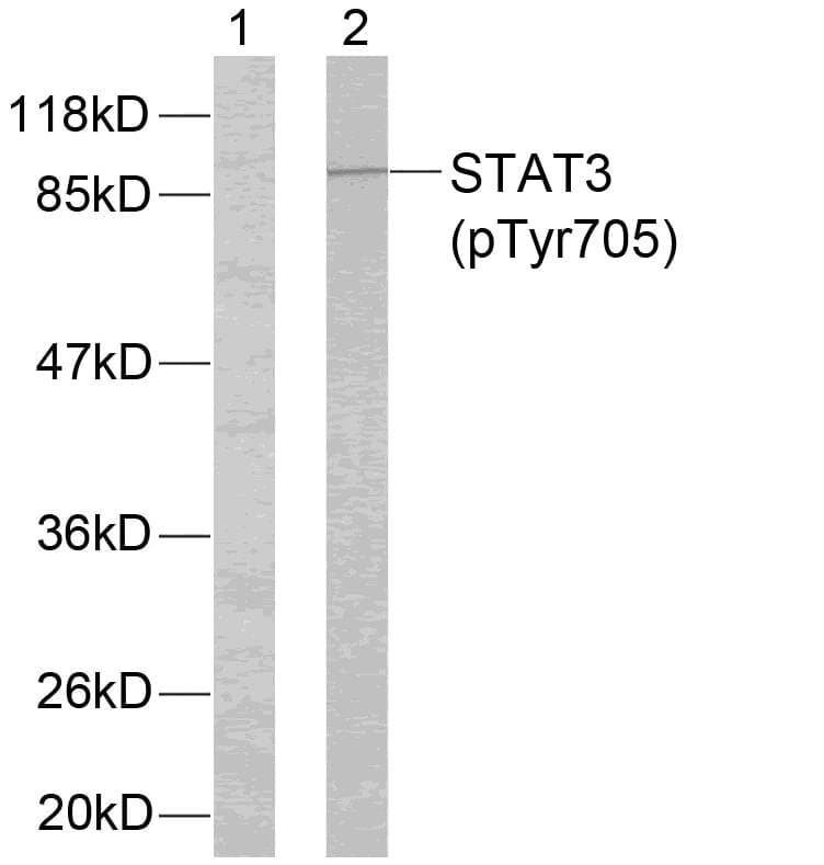STAT3 Antibody (phospho-Tyr705)