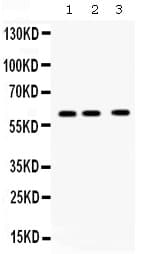 Polyclonal Rabbit anti-Human CCT8 Antibody (IHC, WB)