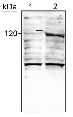HIF2A / EPAS1 Antibody (aa535-631, clone Ep190b, Biotin)