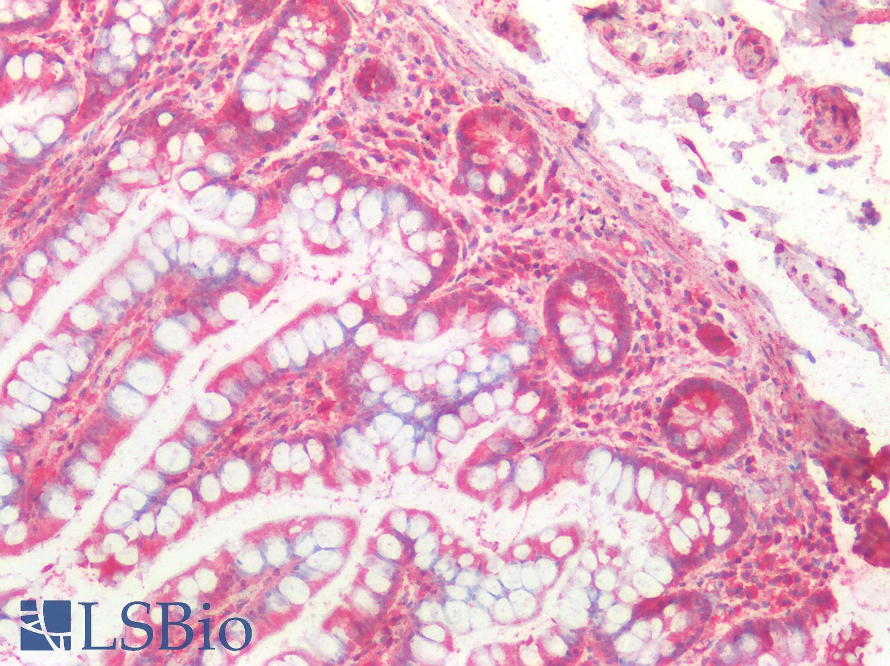 IHC-plus™ Polyclonal Goat anti-Human CTSB / Cathepsin B Antibody (Internal Region, IHC, IF)