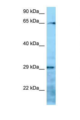 Villin-Like / VILL Antibody (aa176-225)