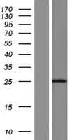 C2orf61 Protein (Over-Expression Lysate Myc-DDK (Flag))