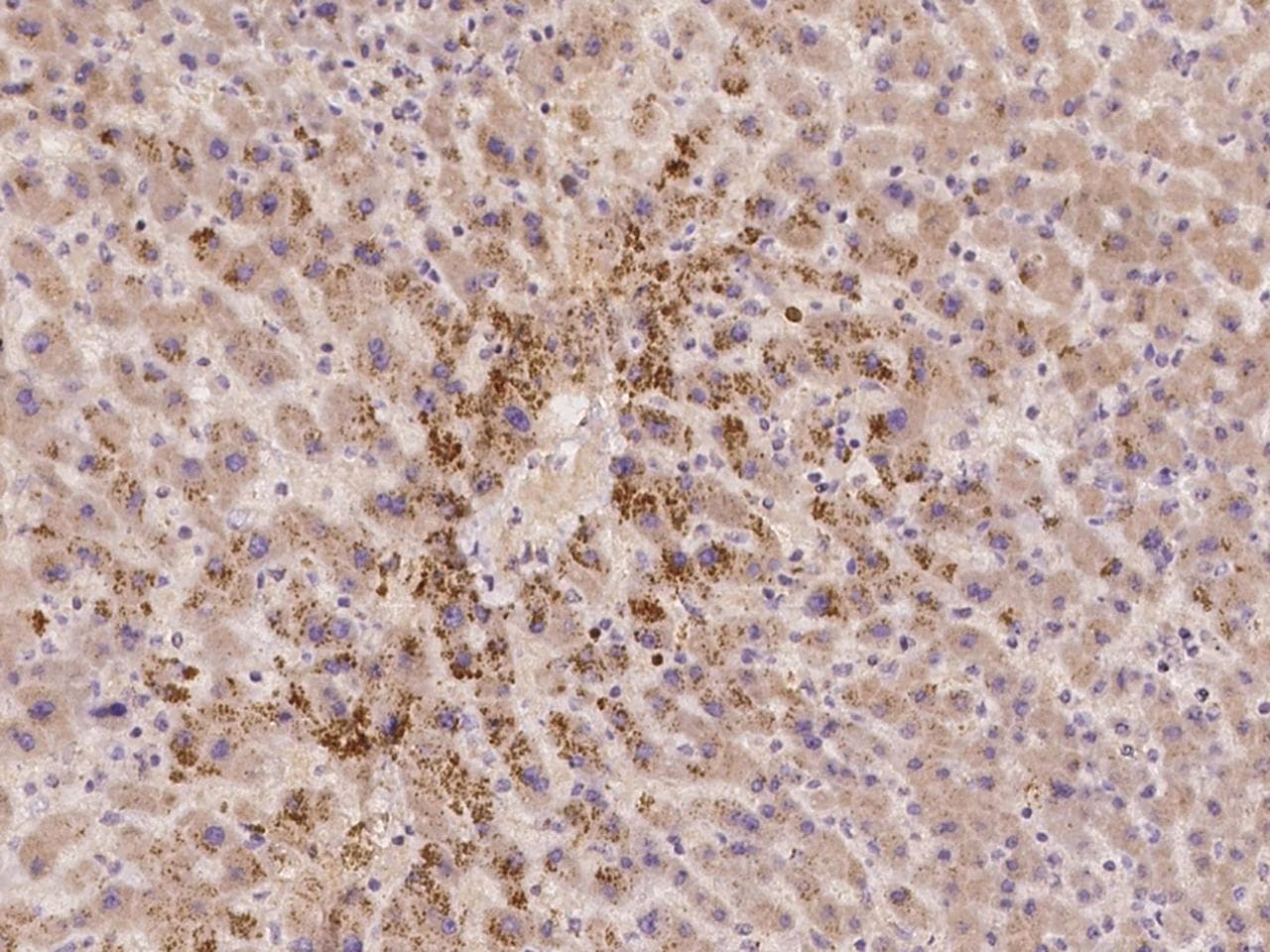 ACBD6 Antibody