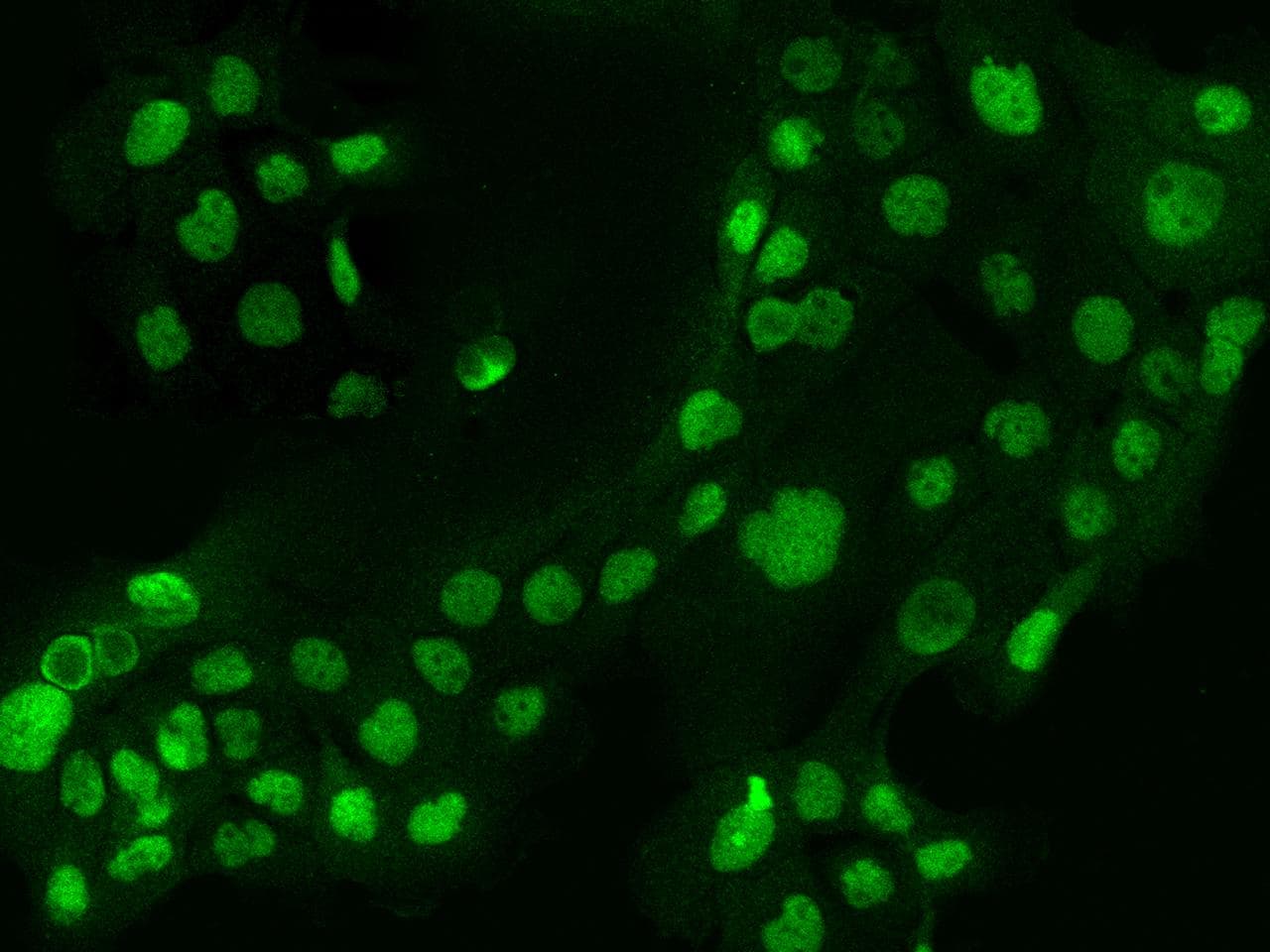 SMEK1 Antibody