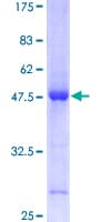 Human CDKN1A / WAF1 / p21 Protein (Recombinant GST)